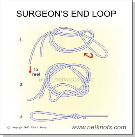 Surgeons End Loop